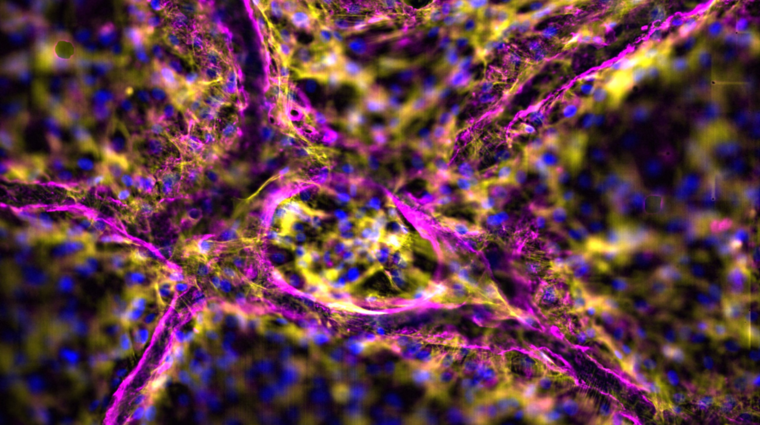 vítězný snímek ročníku 2021 od RNDr. Vlaďky Moulisové z Biomedicínského centra. Fluorescenční mikroskopický snímek zobrazuje decelularizovaný skelet prasečích jater (fialová) s rostoucími endoteliálními buňkami původně izolovanými z prasete (buňky žluté s modrými jádry) v 200násobném zvětšení.